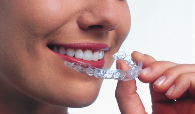 Denti sporgenti? Come risolvere il problema in età adulta